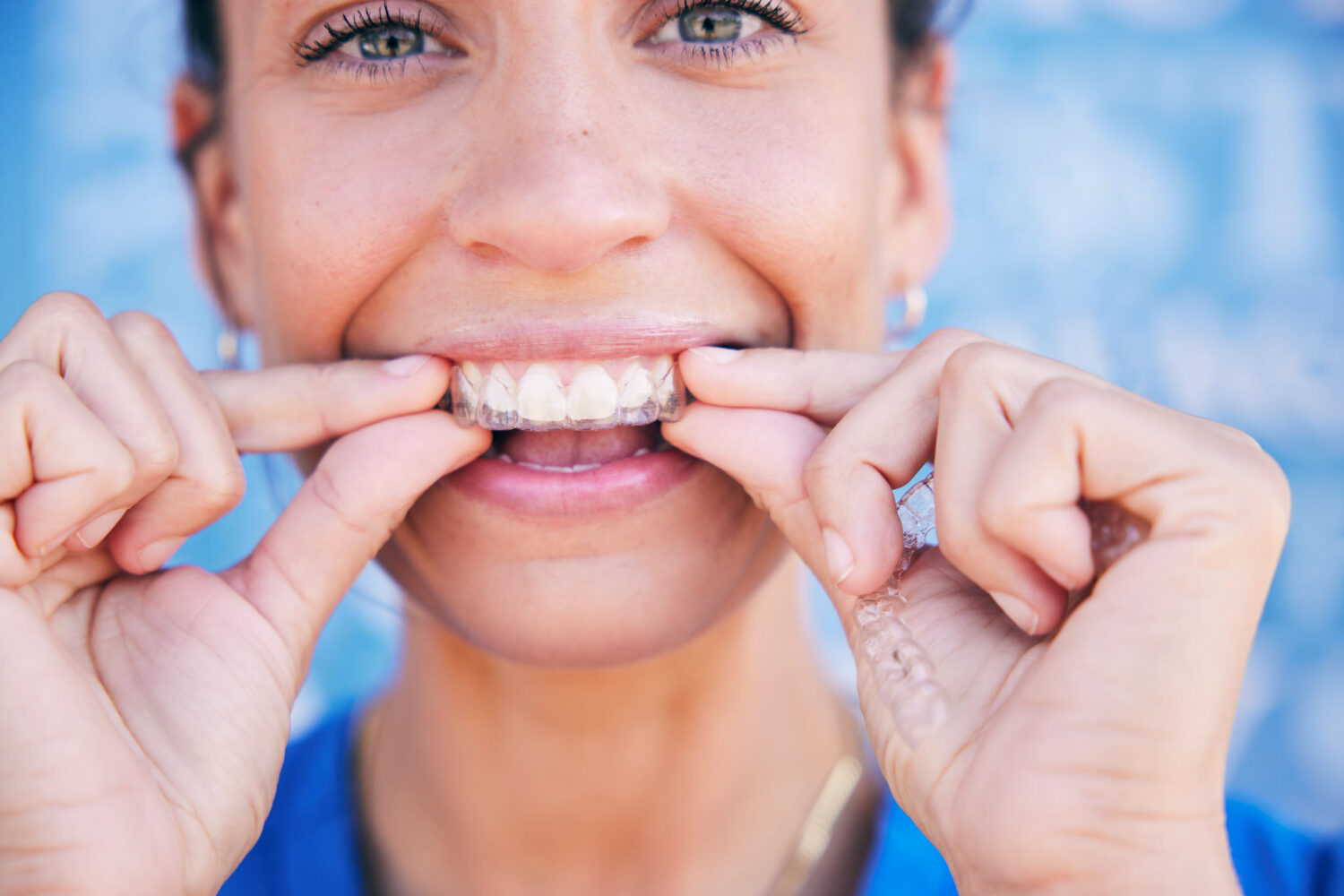 woman putting in her invisalign clear aligners