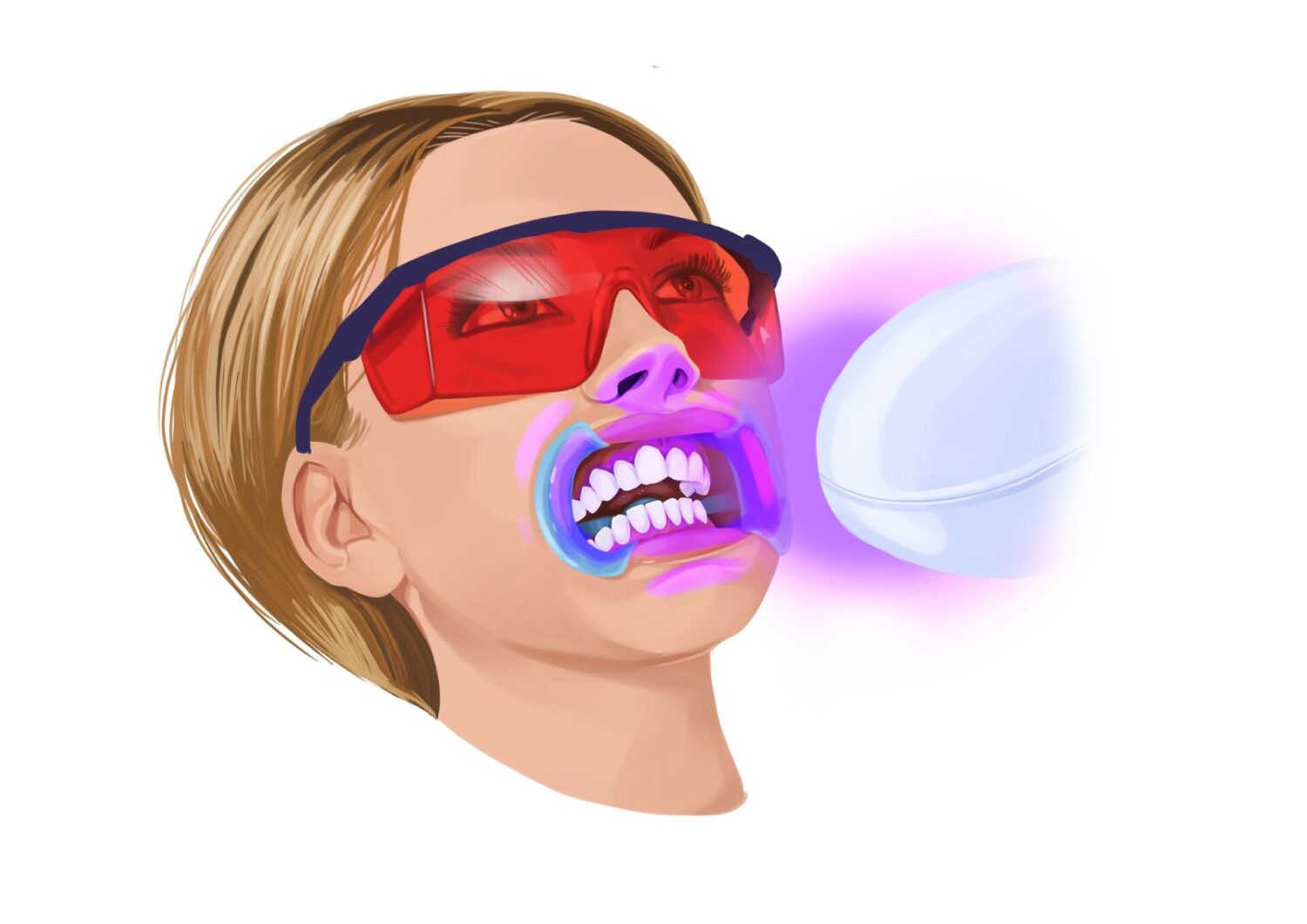 illustration of a woman getting her teeth professionally whitened